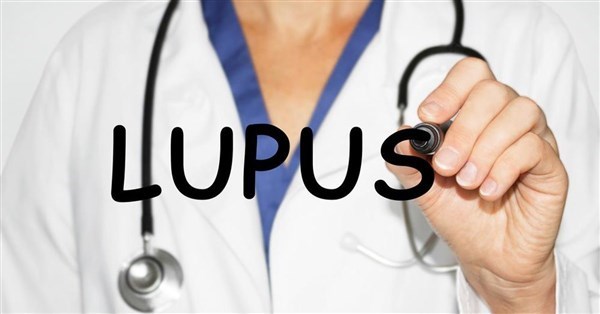 Bệnh lupus ban đỏ có chữa được không ?